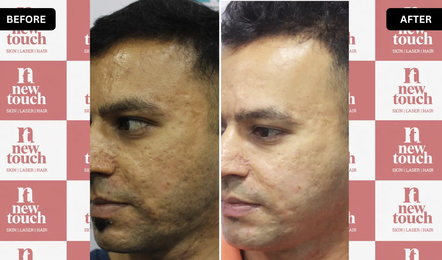 Treatment Result