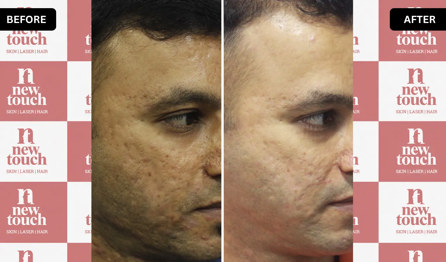 Treatment Result