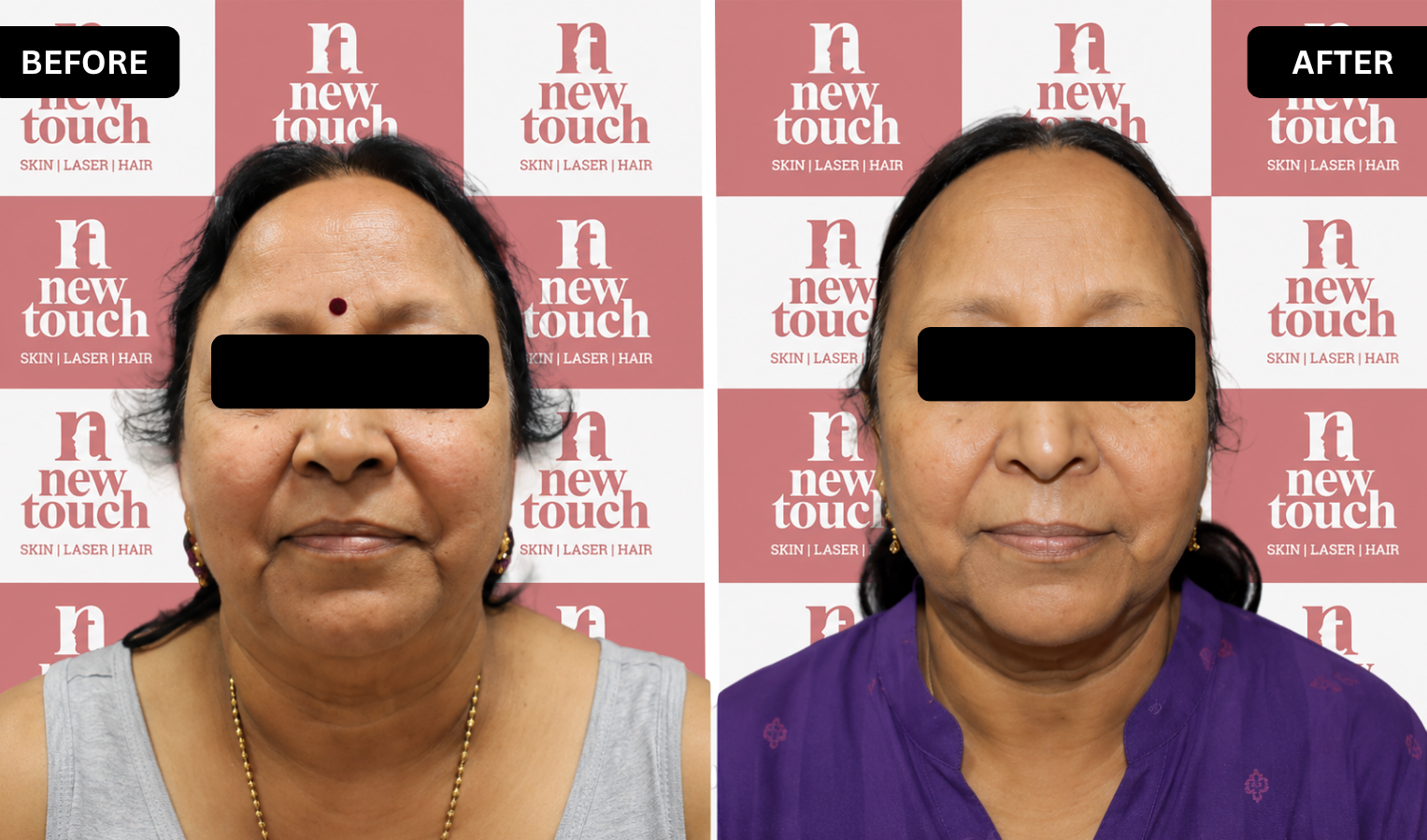 Before and after treatment