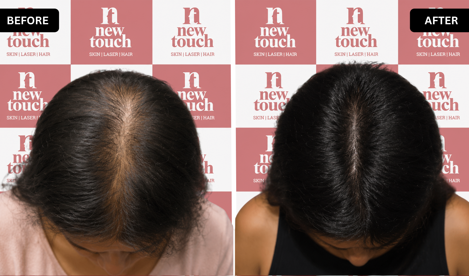 Before and after treatment