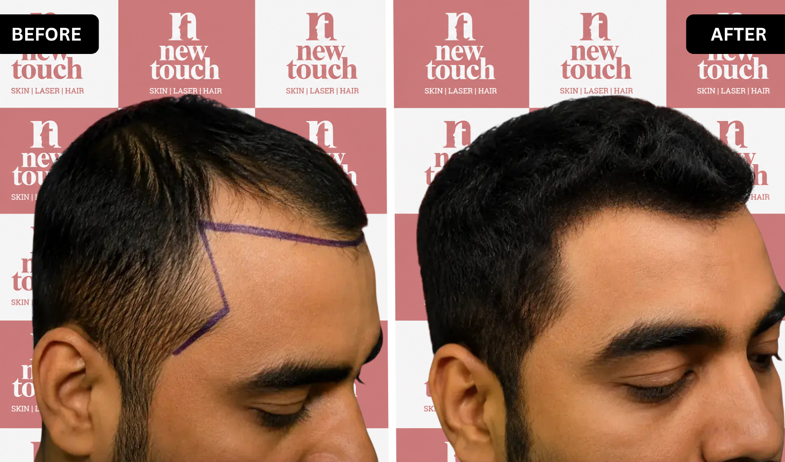 Treatment Result