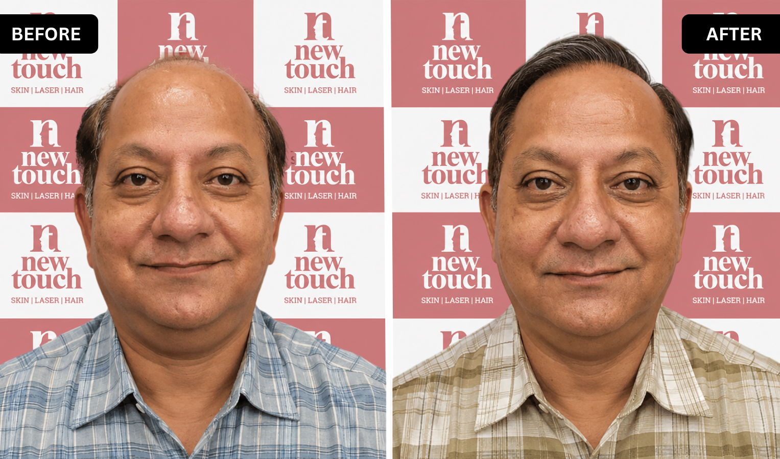 Treatment Result