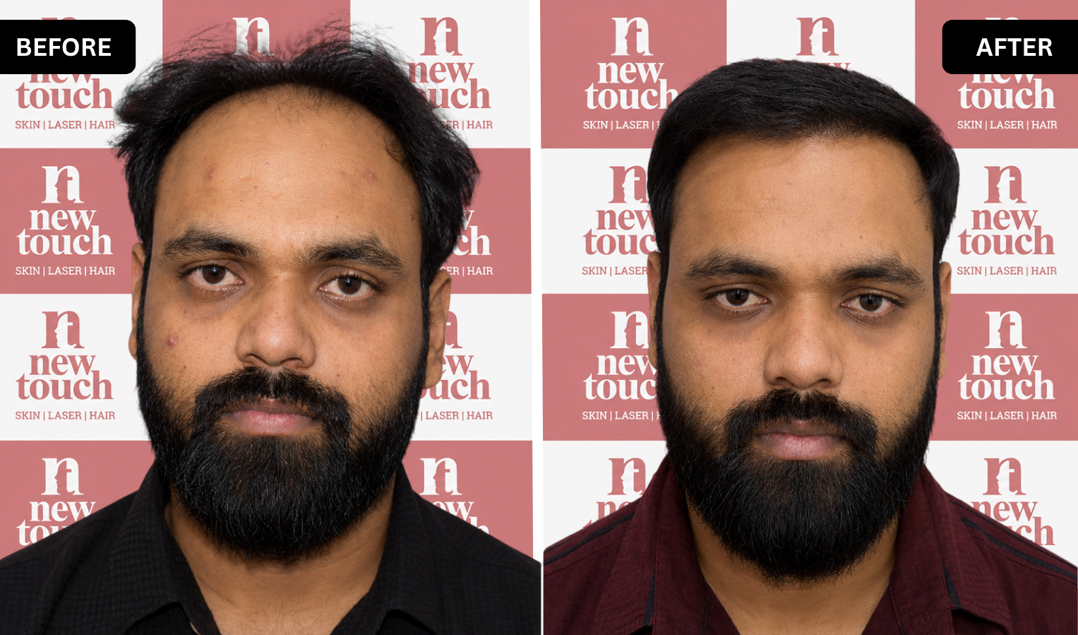 Treatment Result