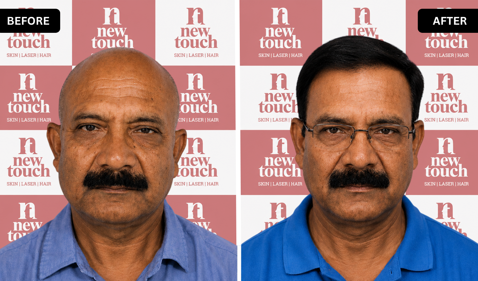 Treatment Result
