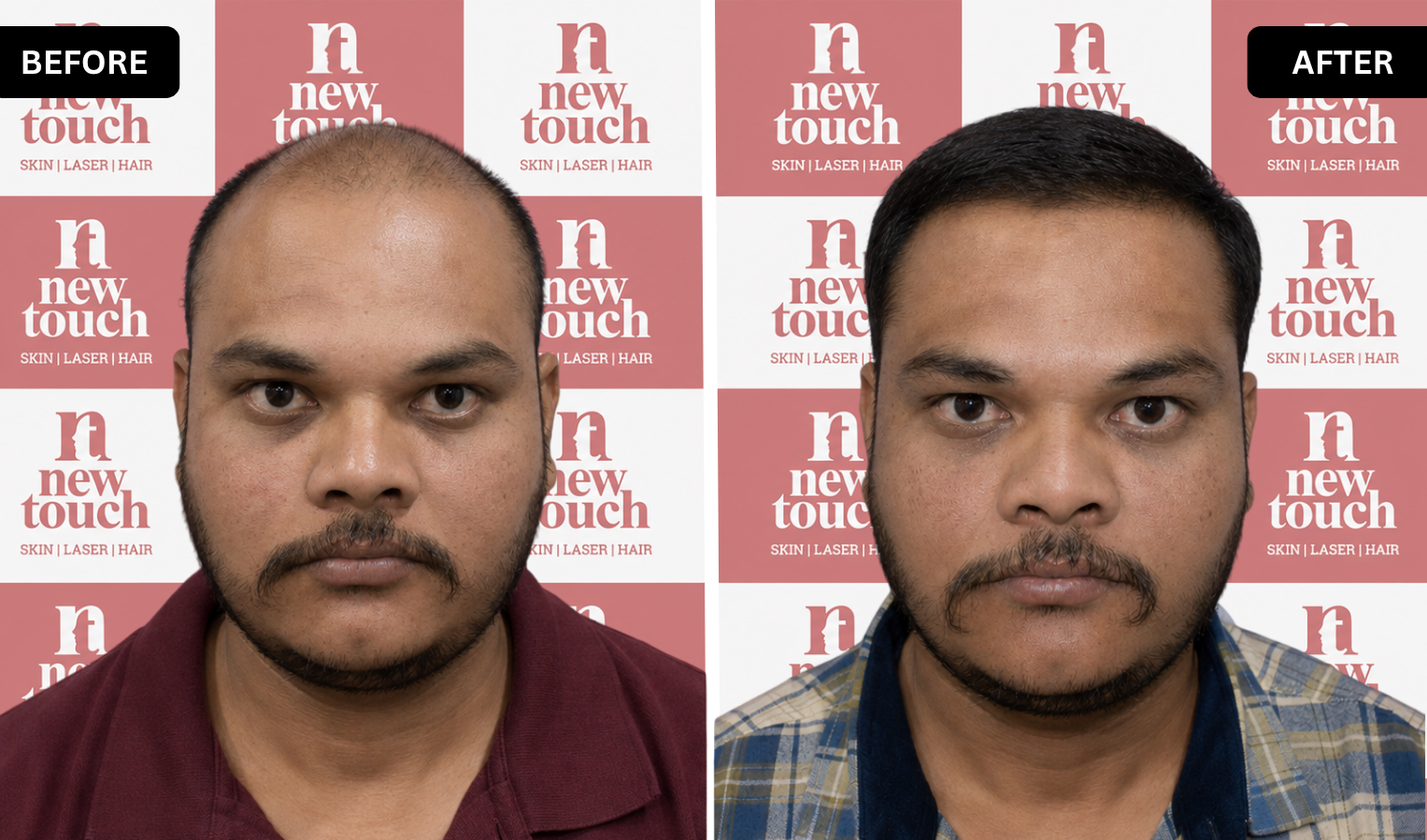 Treatment Result
