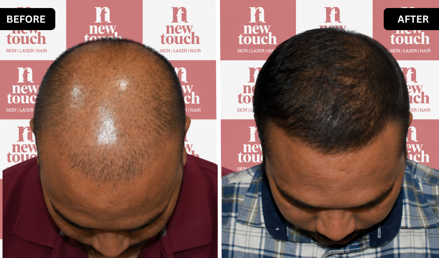 Treatment Result