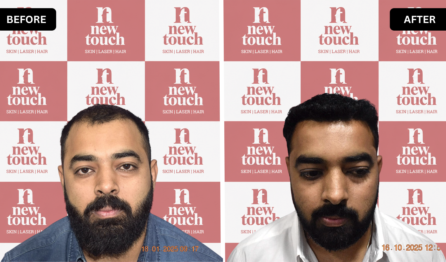 Treatment Result