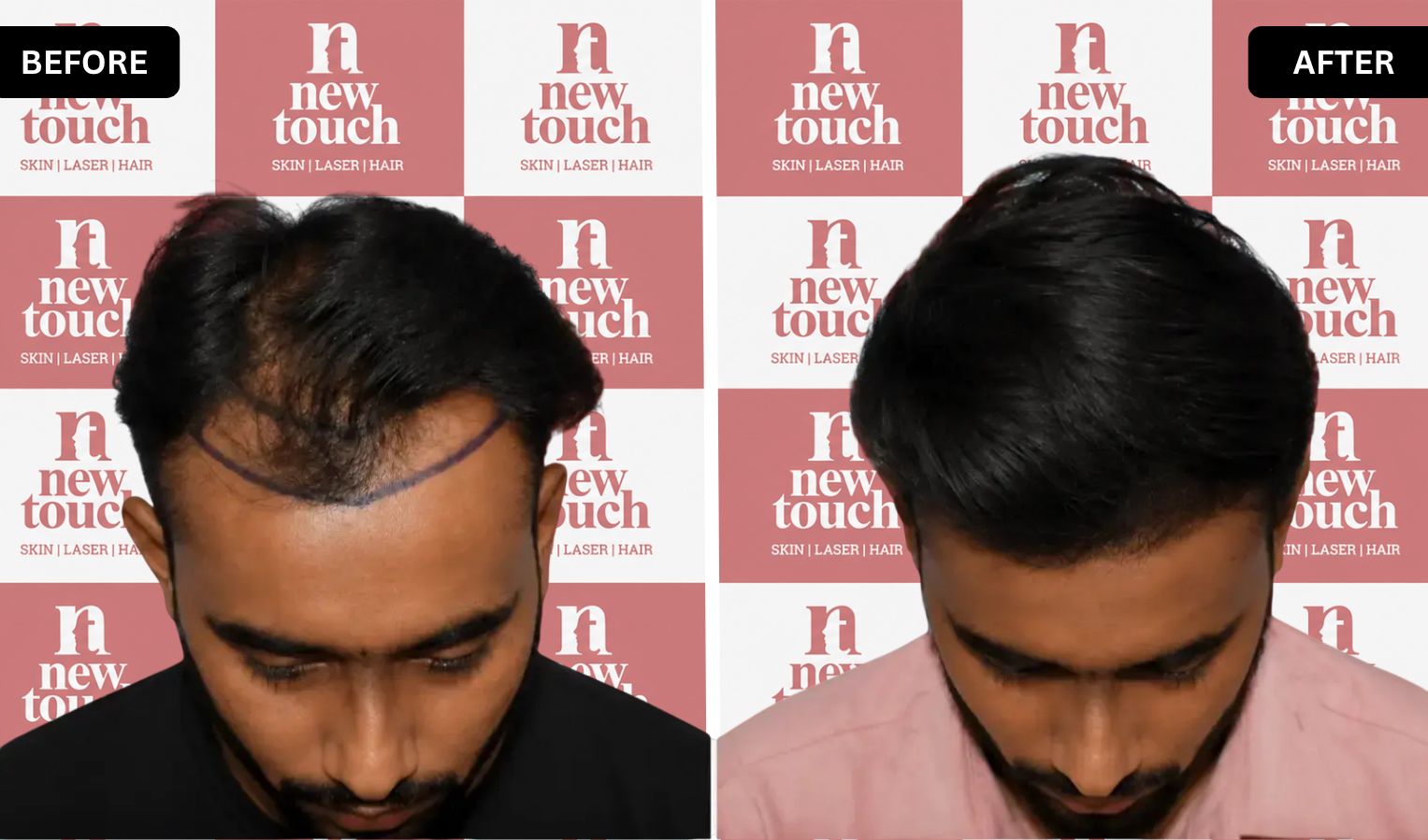Treatment Result
