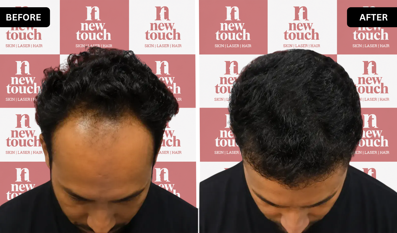 Treatment Result