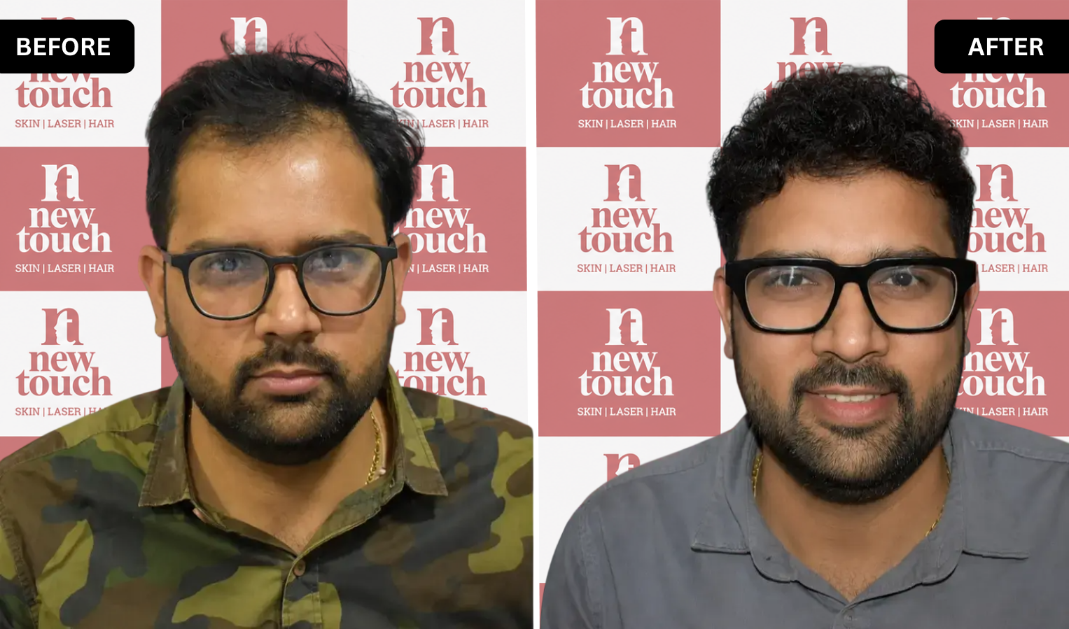 Treatment Result