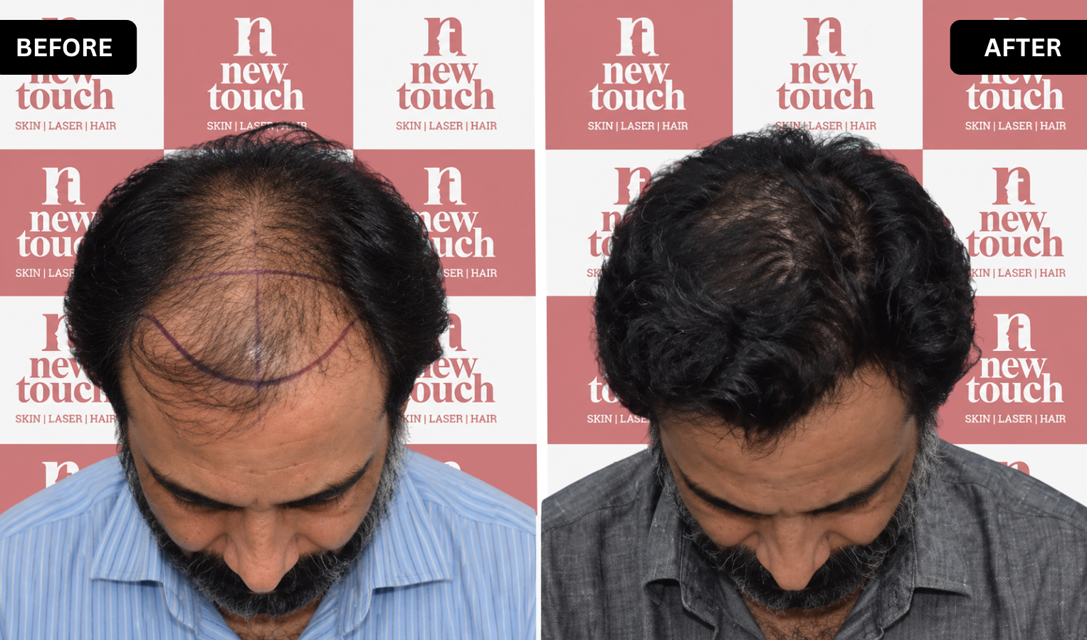 Treatment Result