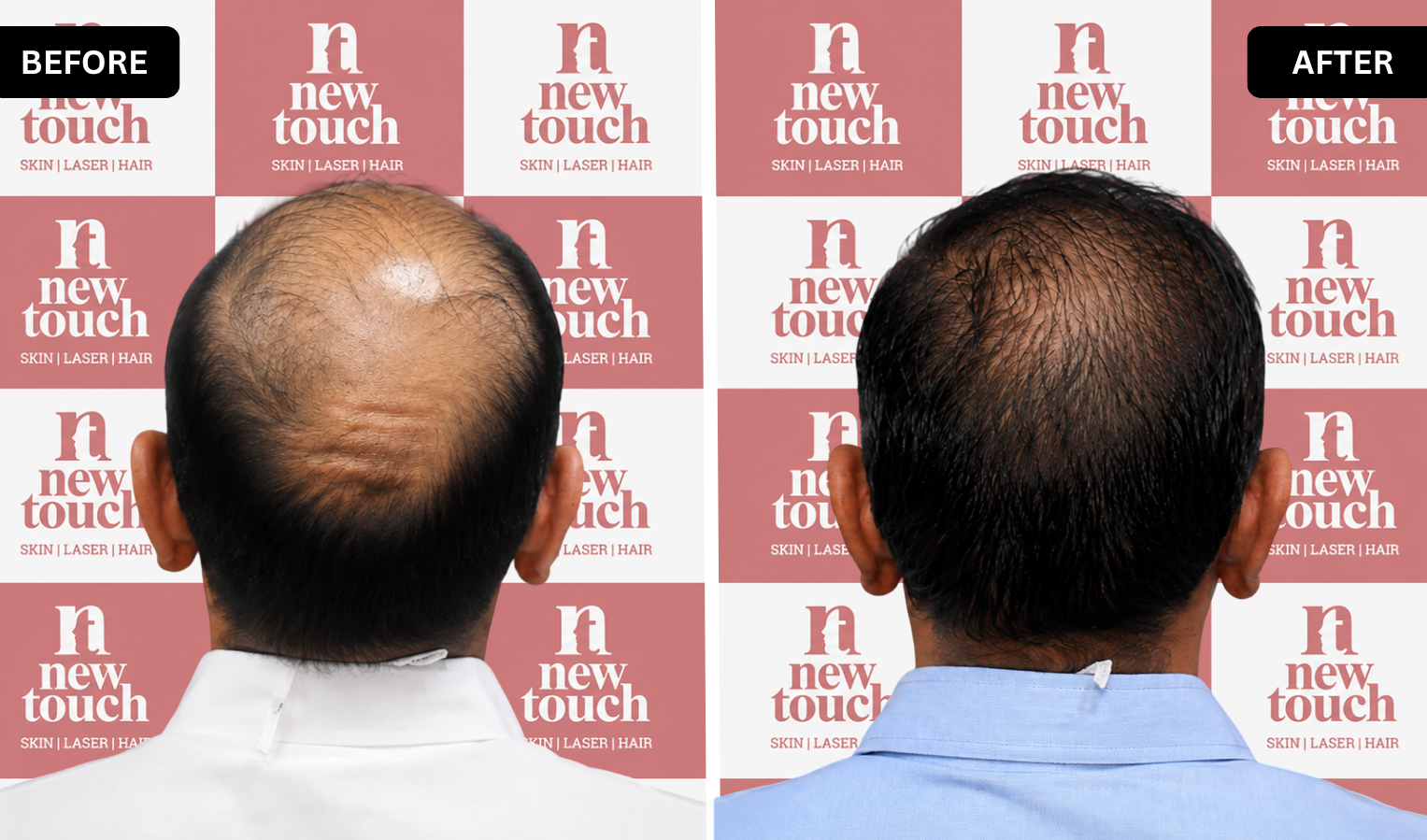 Treatment Result