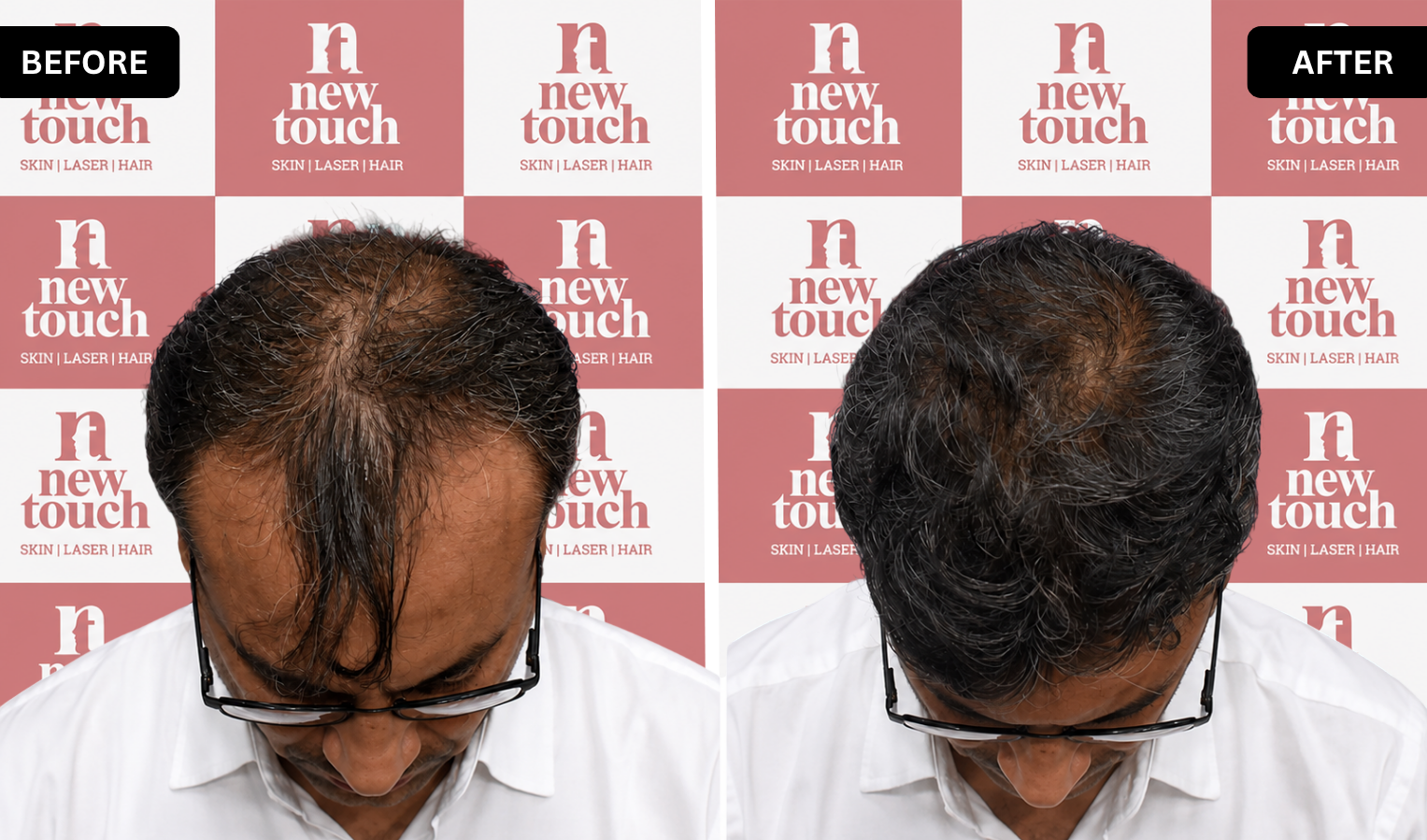 Treatment Result