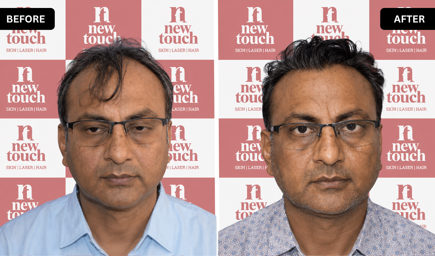 Treatment Result