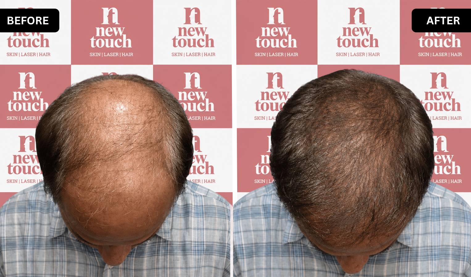 Treatment Result