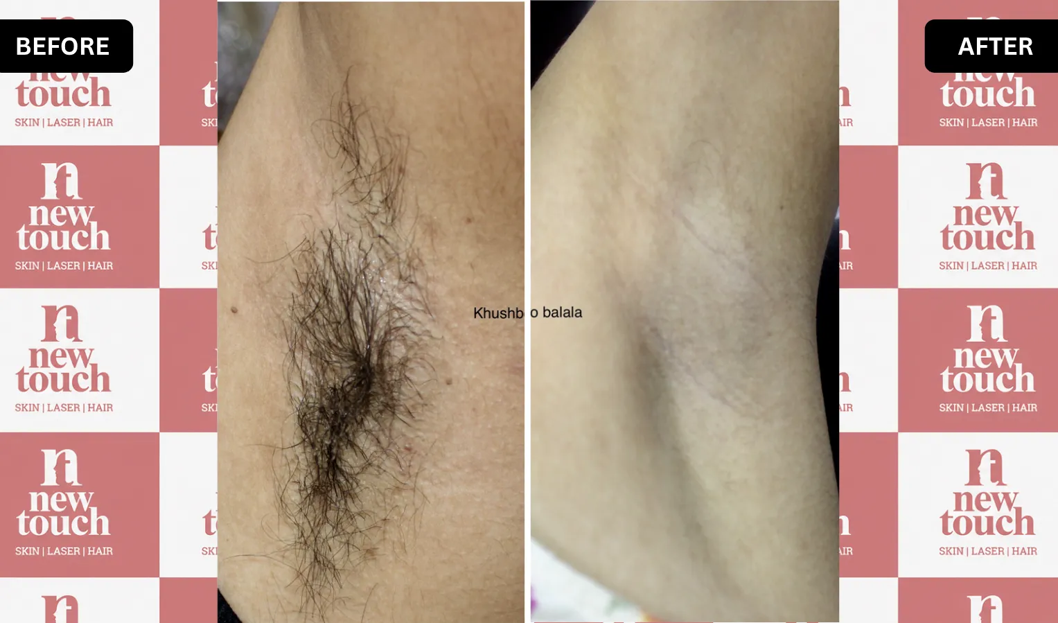 Treatment Result
