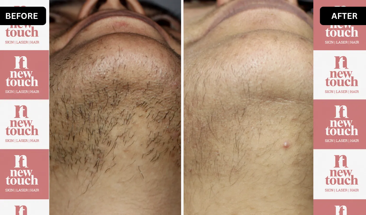 Treatment Result