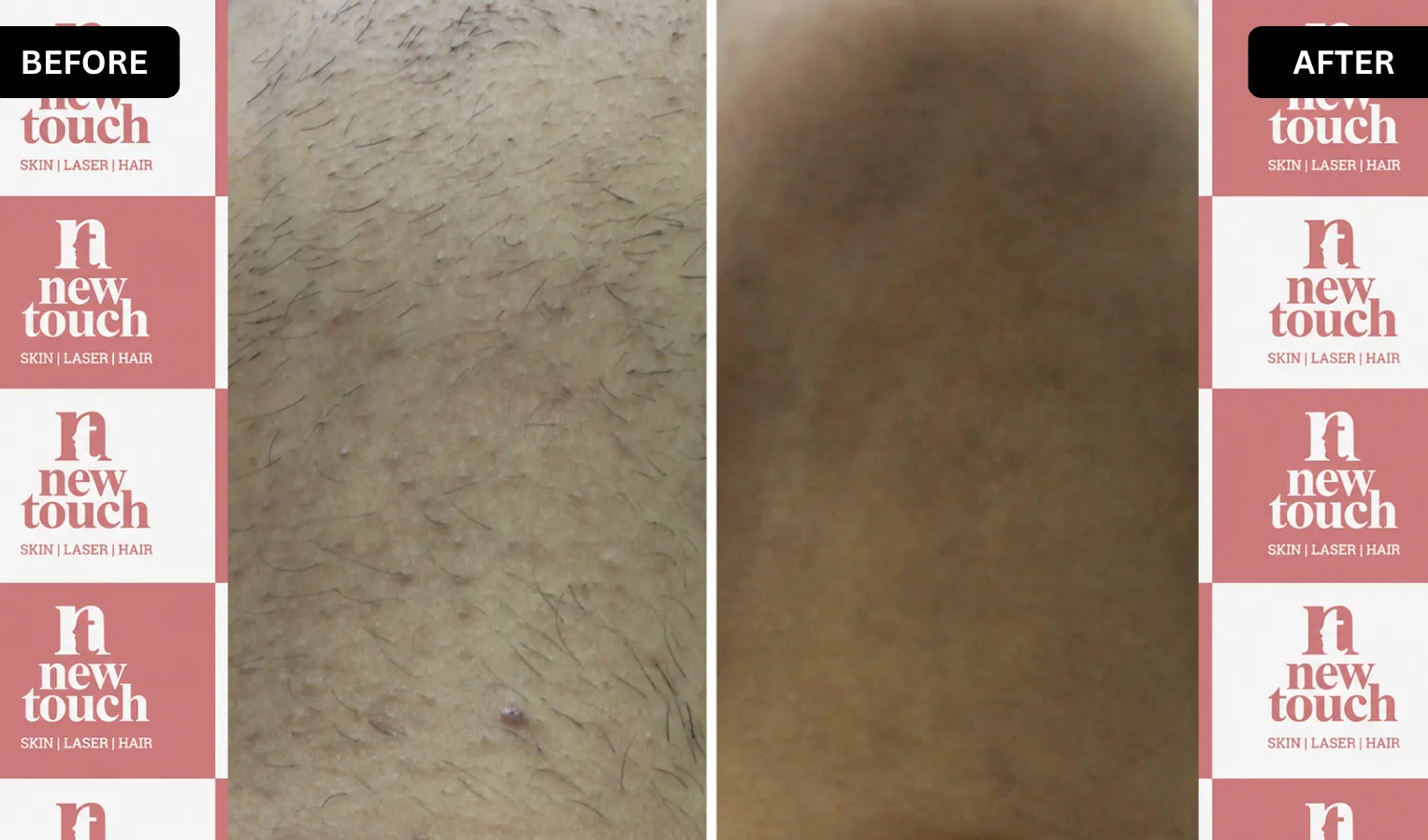 Treatment Result