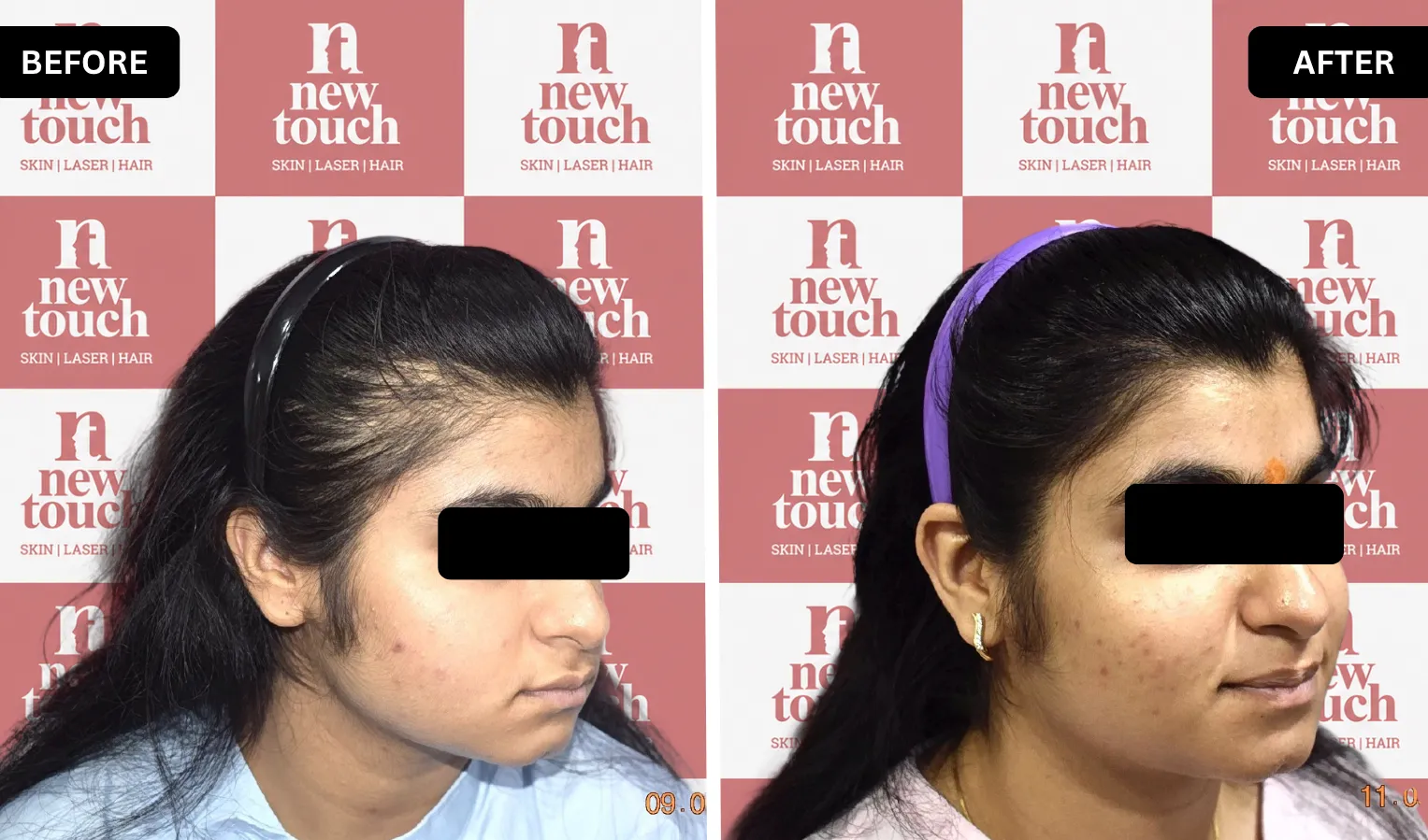 Treatment Result