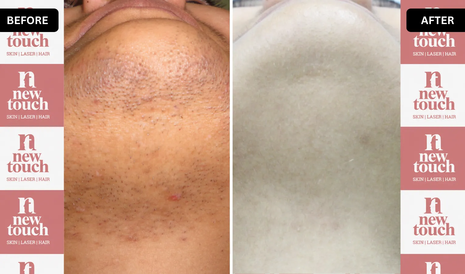 Treatment Result