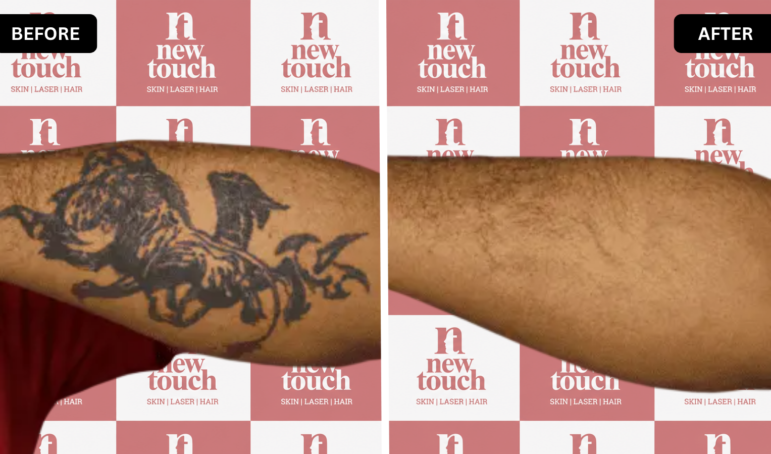 Before and after treatment