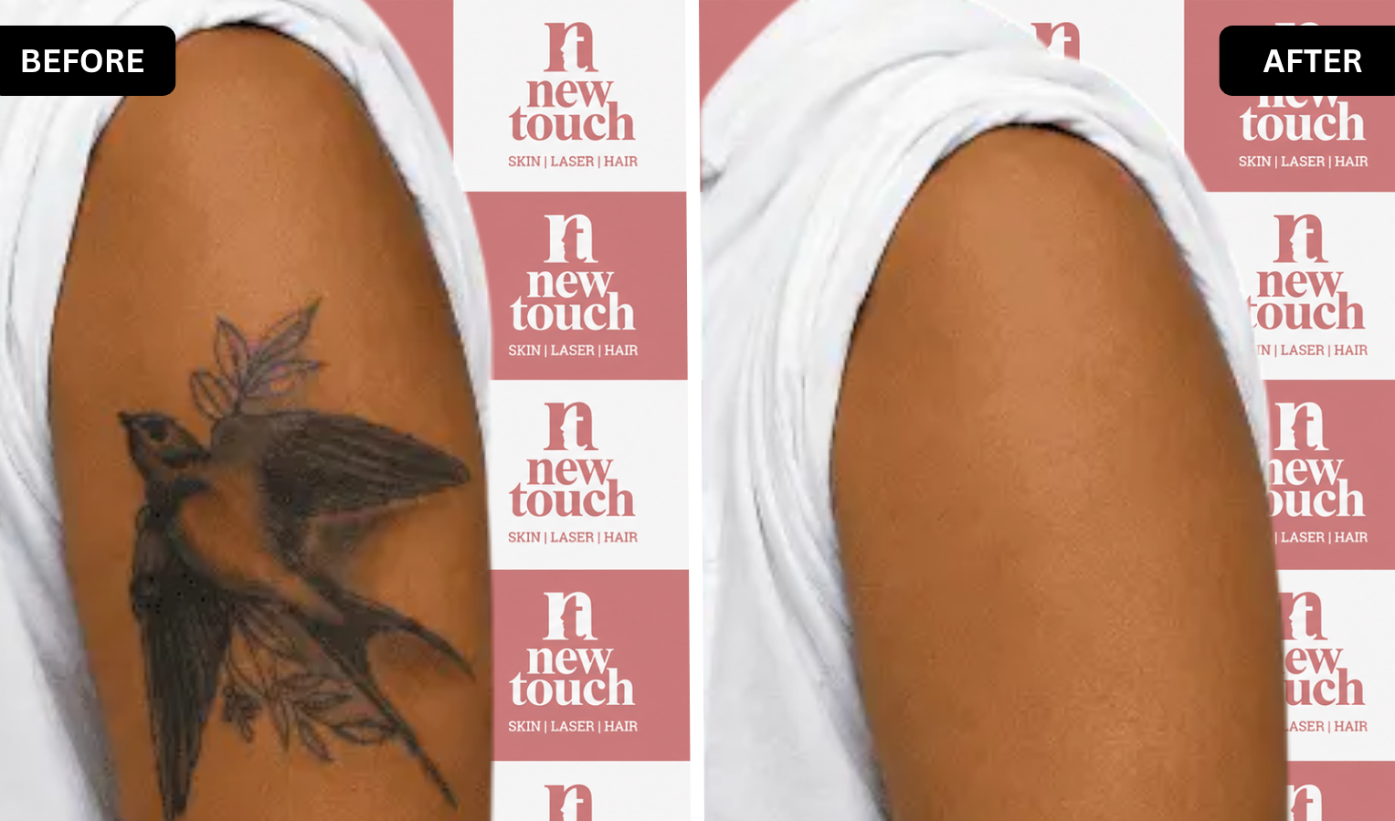 Before and after treatment